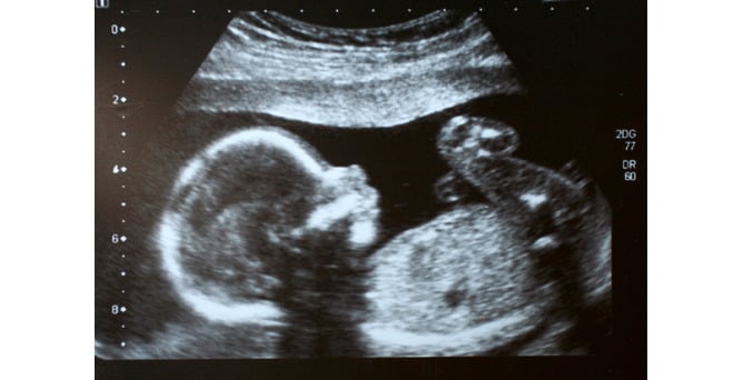 Weight and length: knowing the size of the foetus